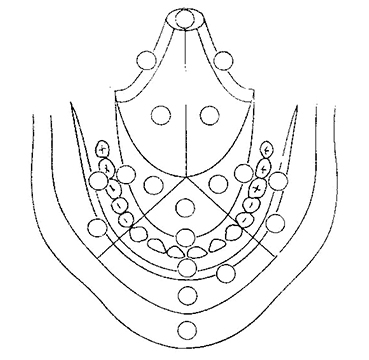 Fig. 1 Pavimento del cavo orale, ventre della lingua.