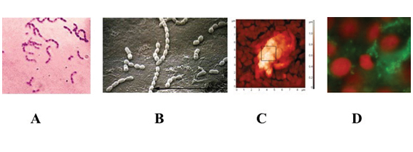 Fig. 1 Streptococcus mutans in forma planctonica (A), adeso ad una superficie abiotica (B), adeso in biofilm ad una superficie abiotica (C) e adeso in biofilm ad una superficie cellulare (D ). Le immagini sono state ottenute con diversi tipi di microscopia. A: microscopia ottica, B: microscopia elettronica a trasmissione, C: microscopia atomica, D: microscopia a fluorescenza.