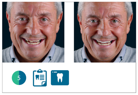 Valutazione digitale del paziente con software Digital Smile System