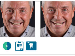 valutazione digitale del paziente con software Digital Smile System