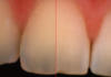 croma dentario