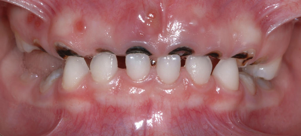 www.chiediloall'odontoiatrapediatrico