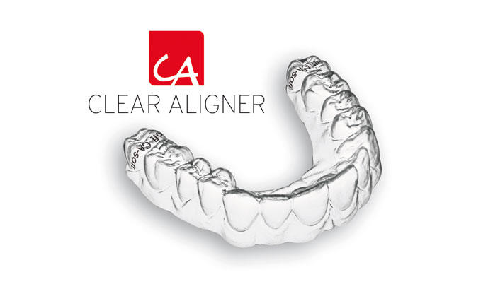 clearaligner