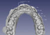 Figura 1. File STL ricavati da una scansione di una doppia di modelli in gesso (arcata superiore e inferiore) con relative misurazioni dell’ampiezza dentale mesio-distale dentale.