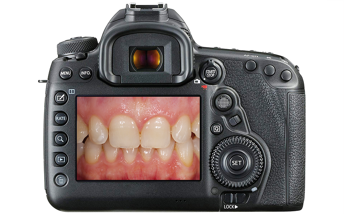 fotografia odontoiatrica