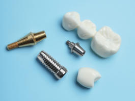 Dispositivi medici marcati CE in odontoiatria: tipologie e requisiti normativi
